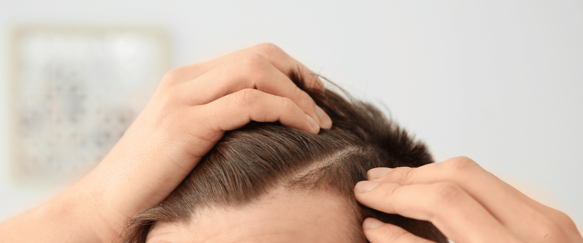 How TED Hair Restoration Works: A Non-Invasive Breakthrough for